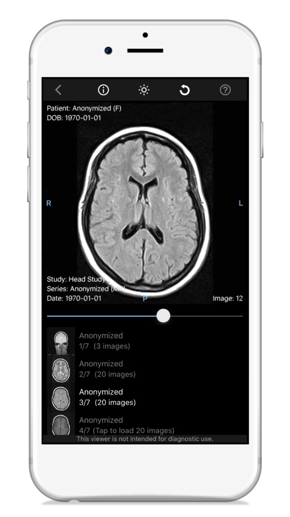 Ambra Health's New App Offers Providers Instant Access to Medical Images 