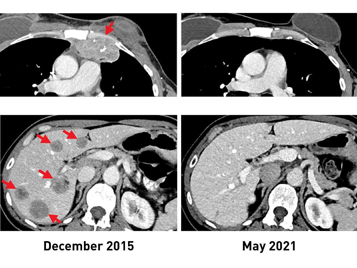 Breast Tissue Comparison - Trial Exhibits Inc.