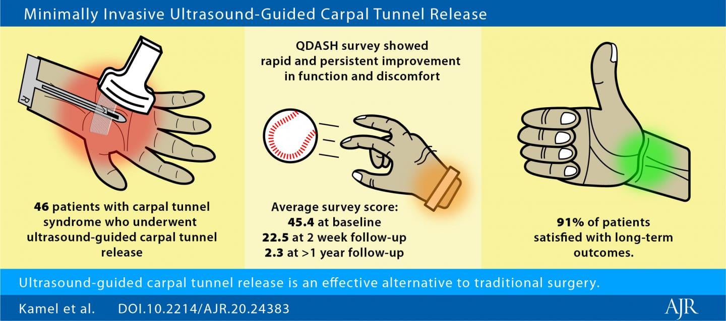 Ultrasound Guidance for Carpal Tunnel