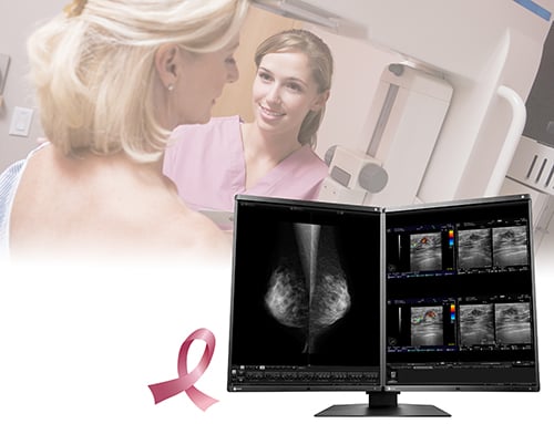 eizo mammography monitor