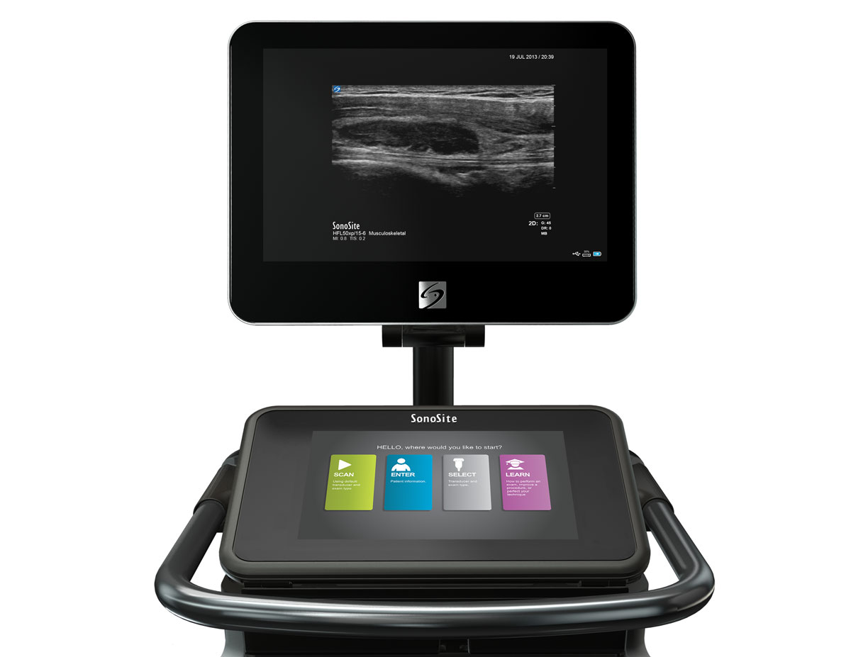 fujifilm ultrasound