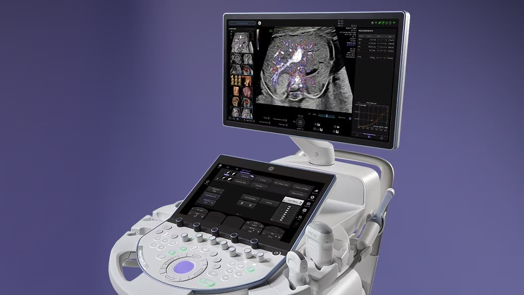 GE HealthCare Unveils AI-Enhanced Women’s Health Ultrasound System