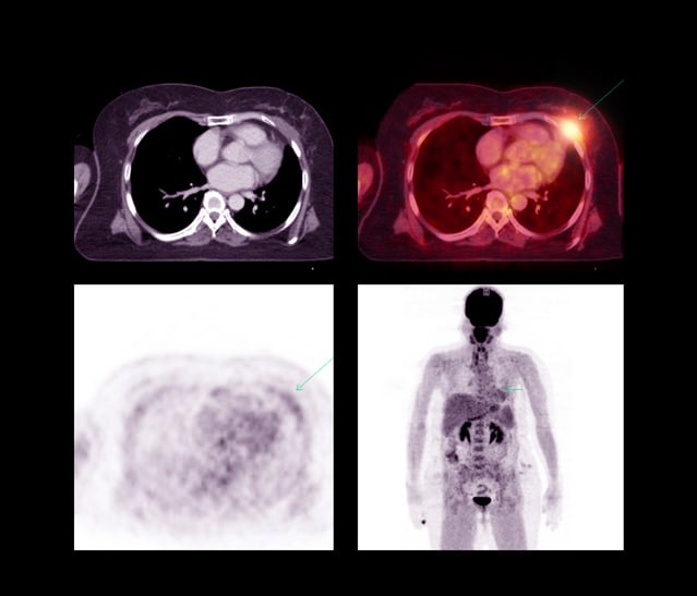 Breast Anatomy  Spectrum Health Lakeland