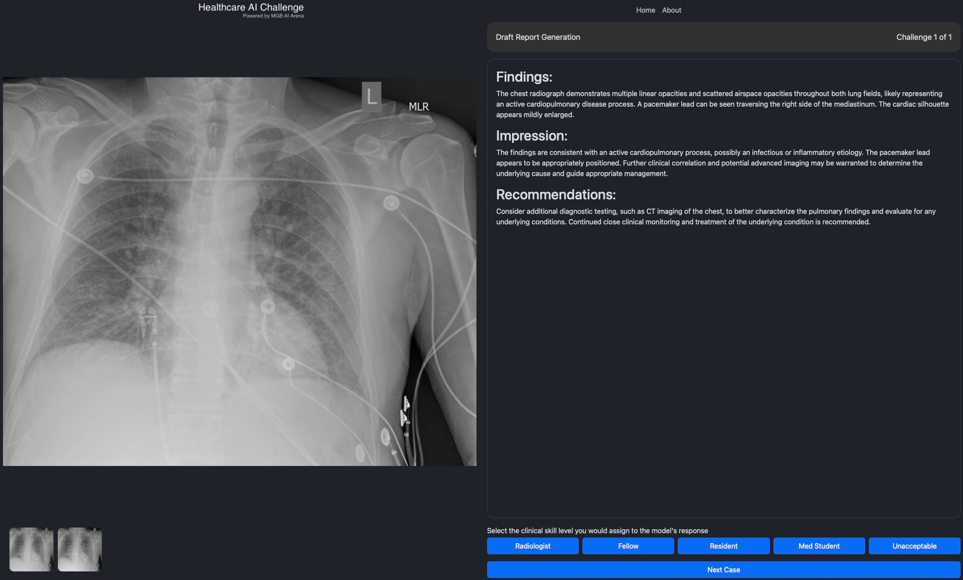 Academic Institutions Launch Groundbreaking Healthcare AI Challenge