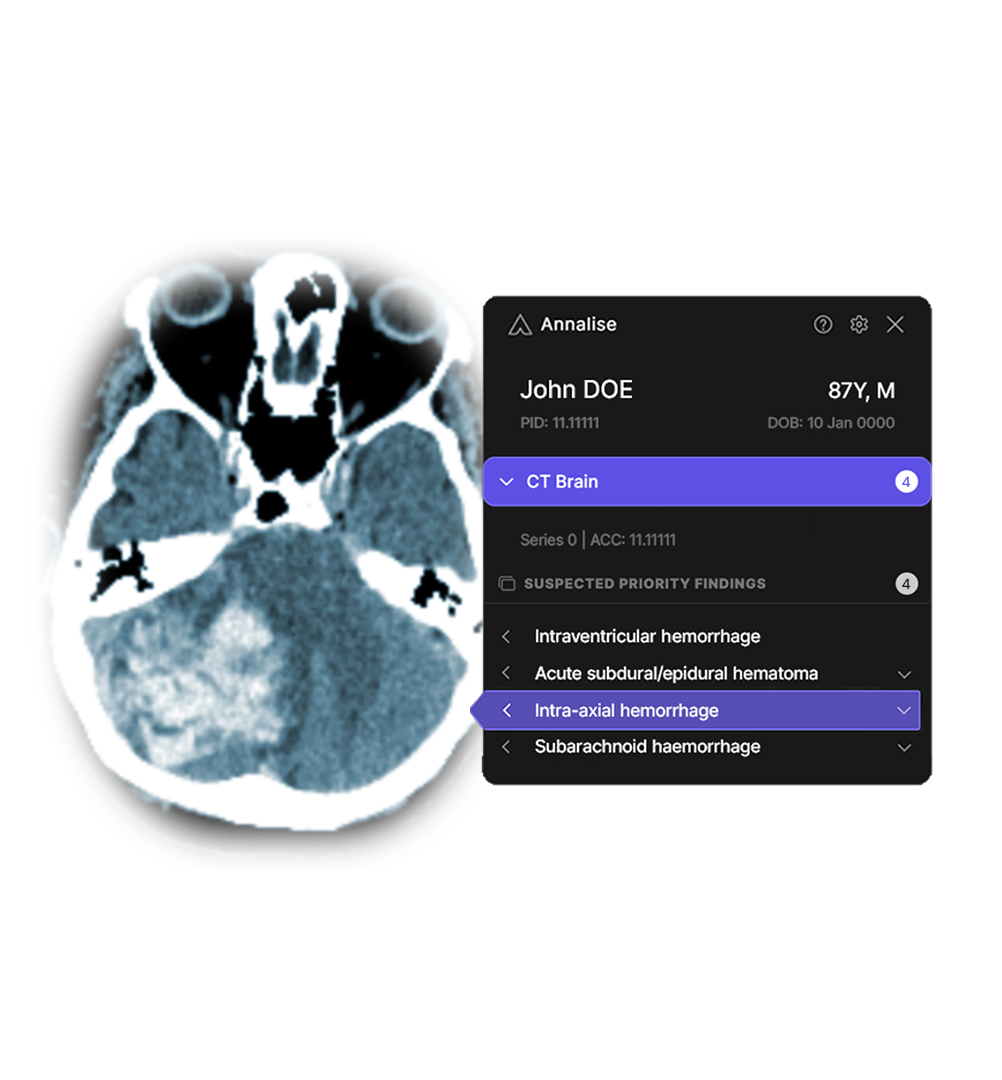 Mass General Brigham and Annalise.ai Announce Collaboration