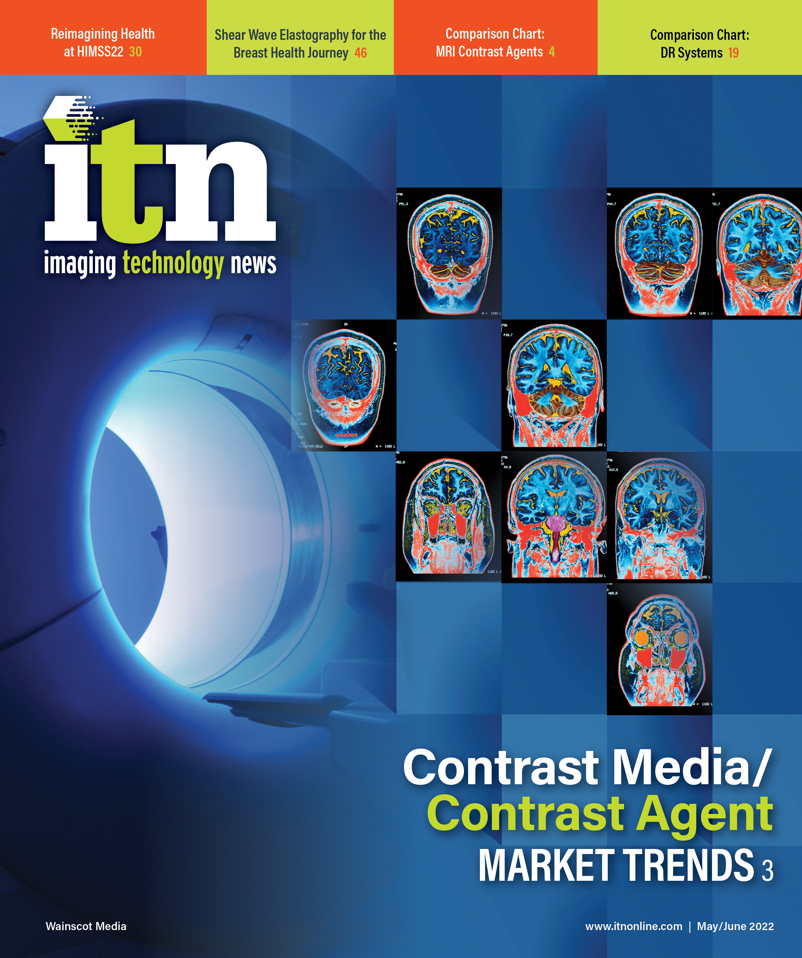 Contrast Media/Contrast Agent Market