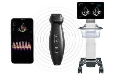 Clarius  Portable Pocket Handheld Ultrasound Scanners