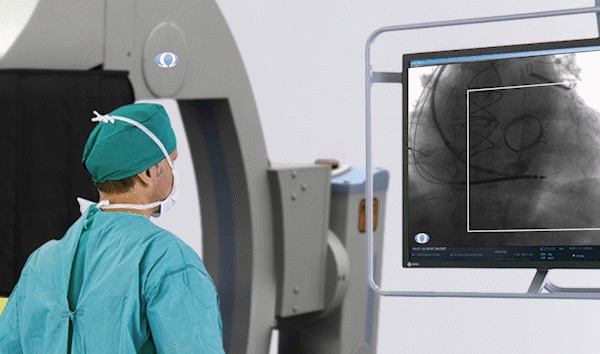 Radiation Protection of Interventional Staff - Omega Medical Imaging