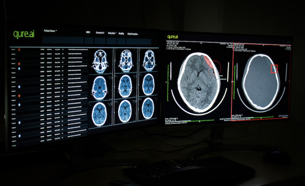 Qure.ai Receives Industry's First 4-in-1 FDA Clearance for Medical Imaging  AI | Imaging Technology News