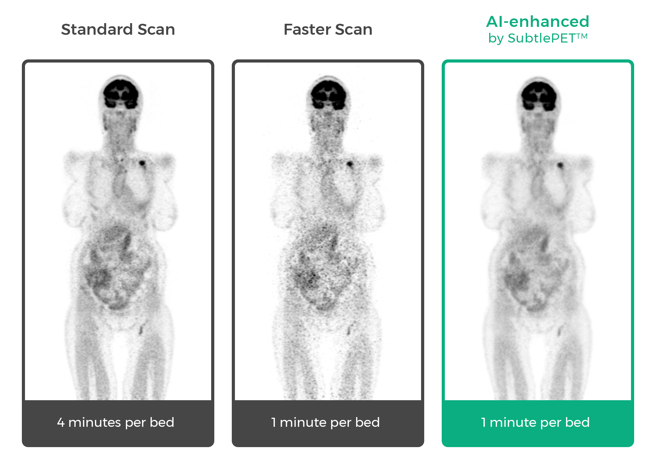 SubtlePET 2.0 Gets CE Mark • APPLIED RADIOLOGY