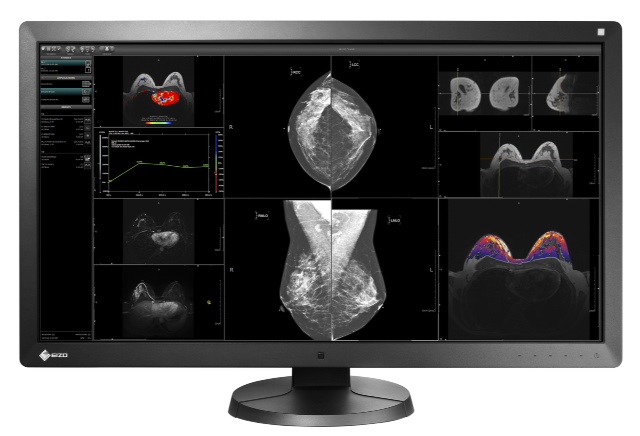 eizo mammography monitor