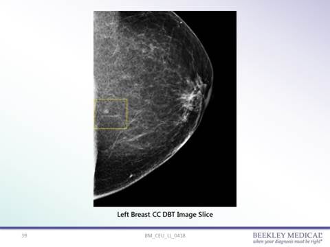 Labeled normal mammograms, Radiology Case