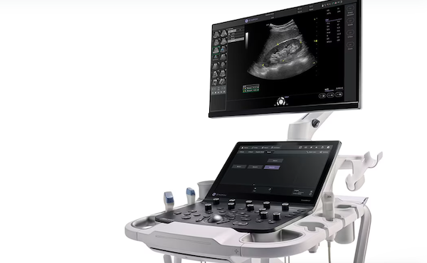 GE HealthCare Introduces Versana Premier to Ultrasound Portfolio