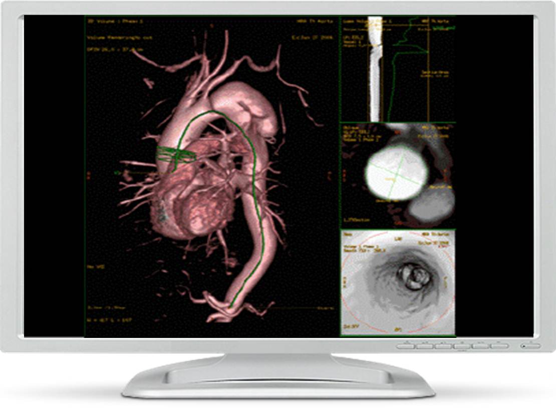 Ge Healthcare Introduces New Cardiac Mri Analysis Software Imaging Technology News