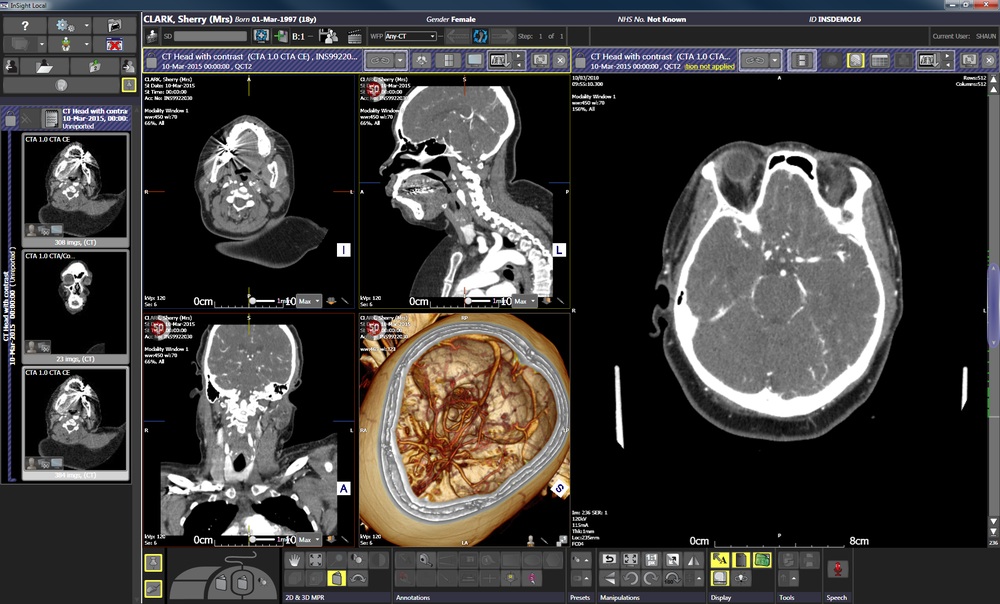 Insignia Medical Systems Chosen For Oxford Image Sharing Services Imaging Technology News