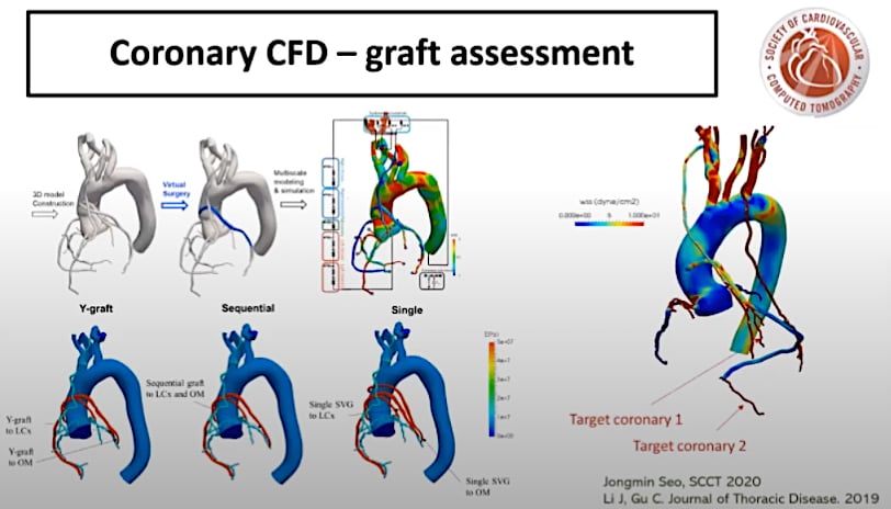 Download Key Trends In Cardiac Ct At The Society Of Cardiovascular Computed Tomography 2020 Meeting Imaging Technology News