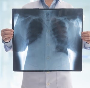 Chest x-ray Getty
