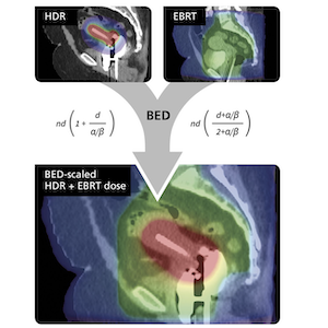GE HealthCare MIM Cancer Therapy