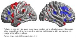 fMRI Identifies Effects of Tetris Practice on the Brain | Imaging  Technology News