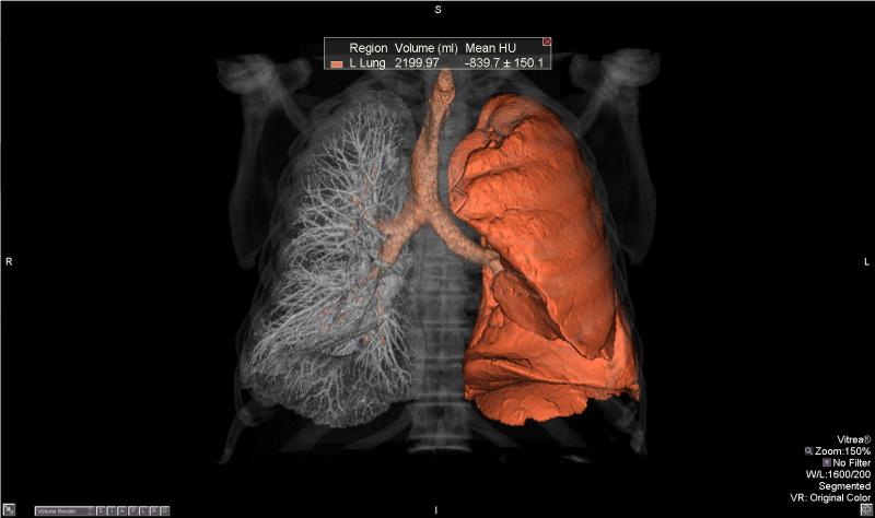 ACR MedCAC Medicare Coverage for CT Lung Cancer Screening