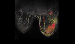 breast MRI, breast cancer, risk prediction, Rahbar