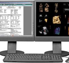 Digisonics OB-View 4.8 OB/GYN PACS Women's Health