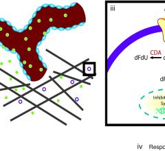 CT Systems Oncology Related Clinical Trial Study Pancreatic Cancer