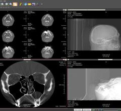 Viztek Web-based PACS RSNA 2013