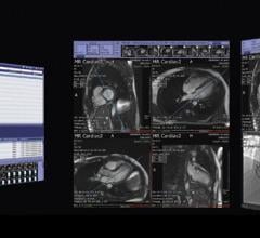 TeraRecon iNteract+ PACS RSNA 2014 Remove Image Viewer