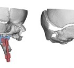 Virtual Surgical Planning 3-D Planning Systems Advanced Visualization