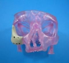 3-D Printed OsteoFab Patient-Specific Facial Device