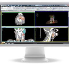 Elekta Monaco 5 Treatment Planning System Radiation Therapy VMAT IMRT