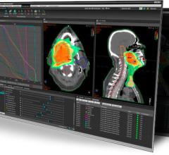 RaySearch RayStation Hitachi Radiation Therapy Treatment Planning Systems