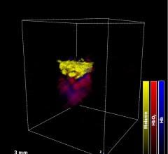 Light and Ultrasound Waves Allow More Precise Excision of Skin Cancer Tumors