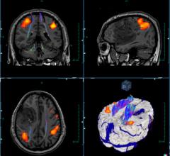 Invivo CorTechs Labs NeuroQuant MRI System Advanced Visualization