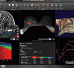 iCad RSNA 2012 VersaVue Enterprise 3.2.1 MRI Software 