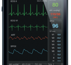 ECG wireless remote access software device