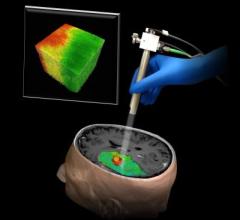 brain tumors, optical coherence tomography, OCT, Johns Hopkins