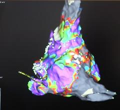 New Appropriate Use Criteria Outlined for Multimodality Imaging of Nonvalvular Heart Disease