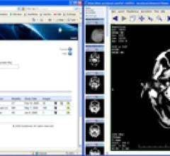 Cloud Computing Supports Orthopedic Image Exchange