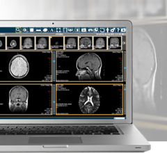 merge iconnect access 5.0 rsna 2013 remote viewing system