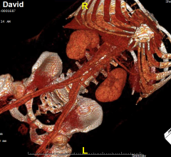 Aidoc Introduces AI Solution for Whole-Body CT Scan Analysis