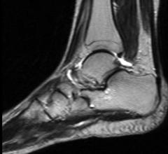 Musculoskeletal Extremity Imaging in Medicare Beneficiaries Increased Over Two Decades