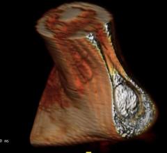 AI Visualize Inc. Debuts Artificial Intelligence Cloud Image Visualization Platform at RSNA 2017