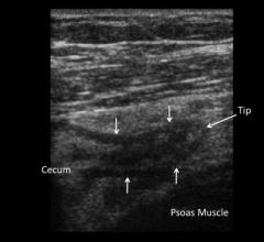 Point of Care Ultrasound Systems CT Scans