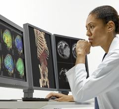 Canon Medical’s Aquilion ONE / PRISM Edition, designed for deep intelligence, integrates artificial intelligence (AI) technology to maximize conventional and spectral computed tomography (CT) capabilities with automated workflows, while providing deep clinical insights to assist physicians in making more informed decisions across the patient’s care cycle. 