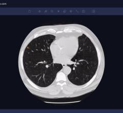 Arterys Demonstrates AI Cloud-Based Medical Image Analysis Solutions at RSNA 2018