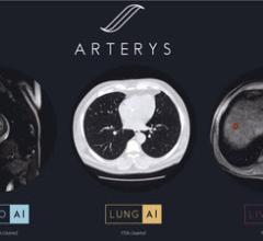 Arterys Receives First FDA Clearance for Oncology Imaging Suite With Deep Learning