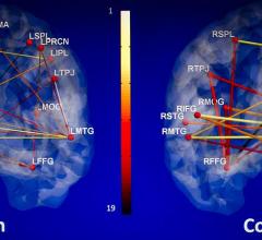 mri systems clinical trials study university alabama auburn psychology autism