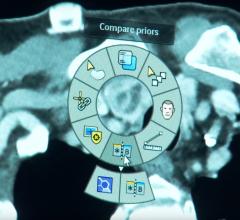 Philips’ Illumeo supports the comparison of current and prior patient images. 